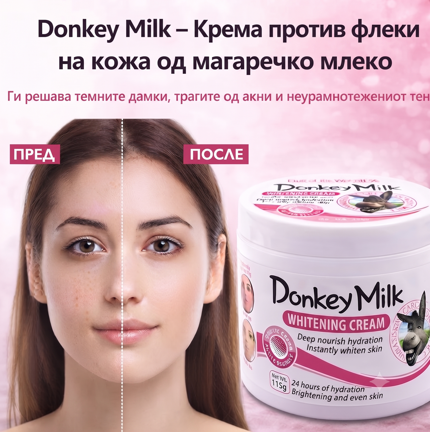 Donkey Milk – Крема против дамки на кожата од магарешко млеко
